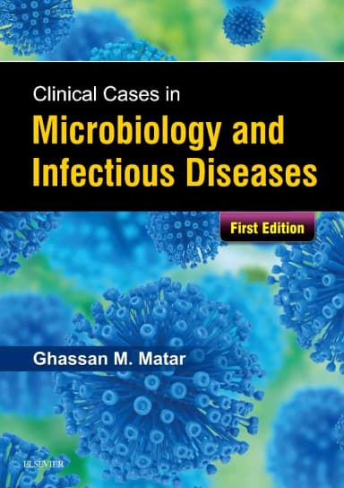 Image of - Clinical Cases in Microbiology and Infectious Diseases | Paperback