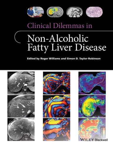 Image of - Clinical Dilemmas in Non-Alcoholic Fatty Liver Disease | Paperback