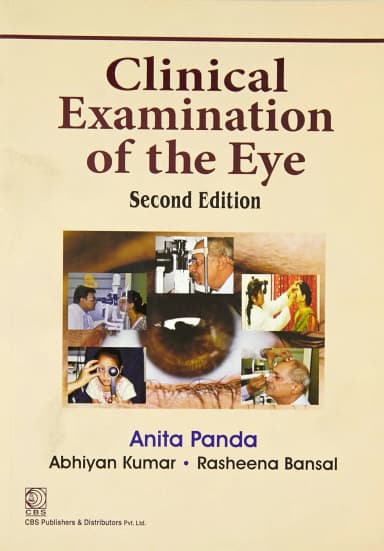 Image of - Clinical Examination of the Eye | 2nd Edition | Paperback