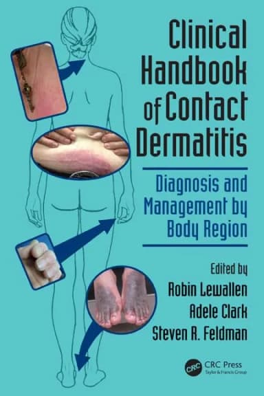 Image of - Clinical Handbook of Contact Dermatitis | Paperback