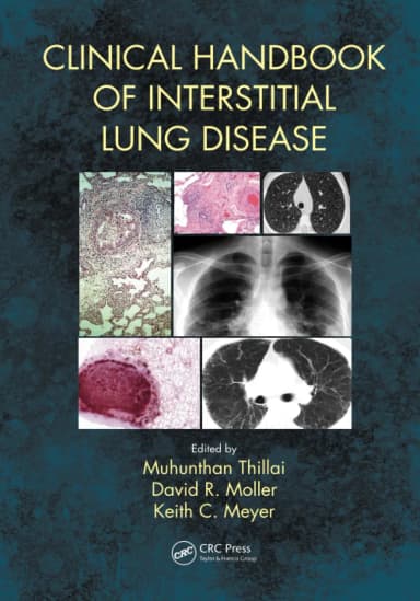 Image of - Clinical Handbook of Interstitial Lung Disease | Paperback