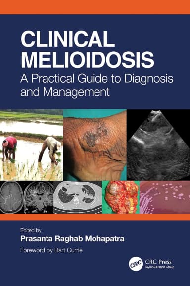 Image of - Clinical Melioidosis A Practical Guide To Diagnosis And Management | Paperback