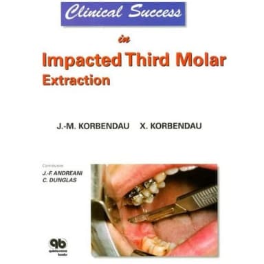 Image of - Clinical Success in Impacted Third Molar Extraction | Paperback
