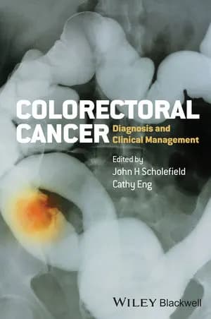 Image of - Colorectal Cancer Diagnosis and Clinical Management | 1st Edition | Hardcover