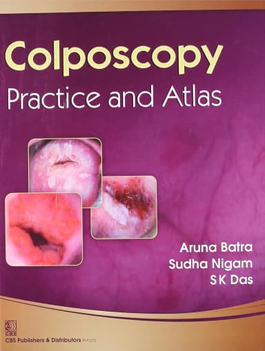 Image of - Colposcopy—Practice and Atlas