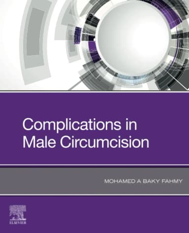 Image of - Complications in Male Circumcision | Paperback