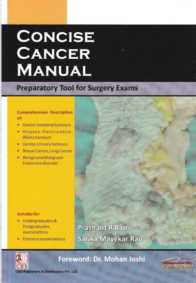 Image of - Concise Cancer Manual | Paperback