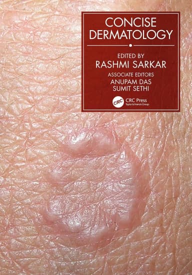 Image of - Concise Dermatology | Paperback