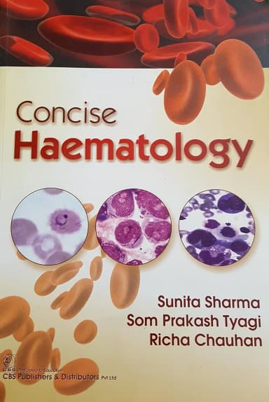 Image of - Concise Haematology | Paperback
