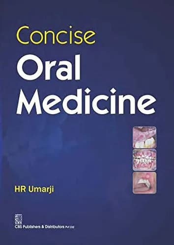 Image of - Concise Oral Medicine