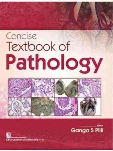 Image of - Concise Textbook of Pathology | Paperback