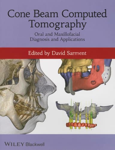 Image of - Cone Beam Computer Tomoraphy | Paperback