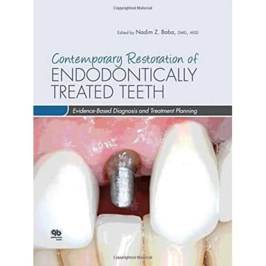 Image of - Contemporary Restoratin of Endodontically Treated Teeth | Hardcover