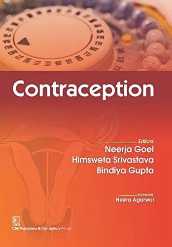 Image of - Contraception | Paperback