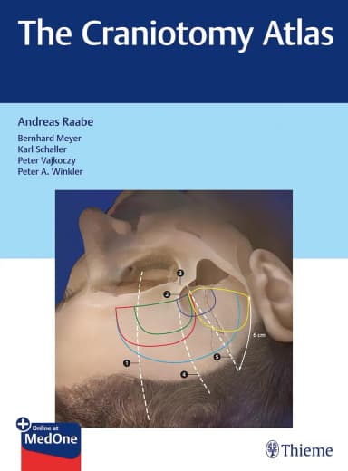 Image of - The Craniotomy Atlas | Hardcover