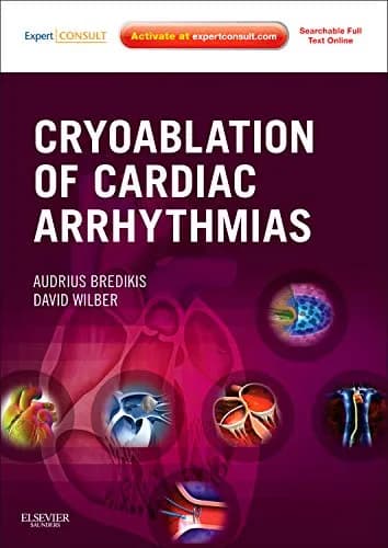 Image of - Cryoablation of Cardiac Arrhythmias | Hardcover