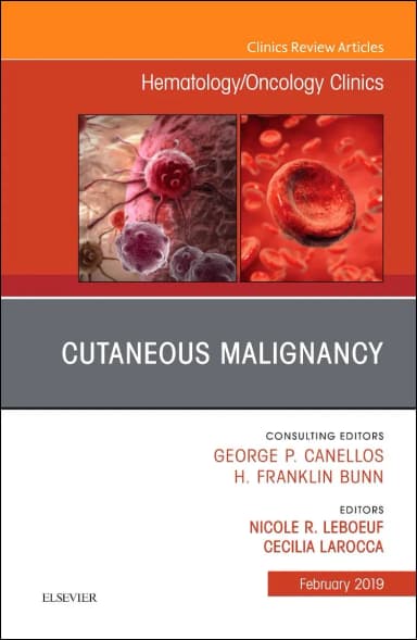 Image of - Cutaneous Malignancy Hematology/Oncology Clinics | Hardcover