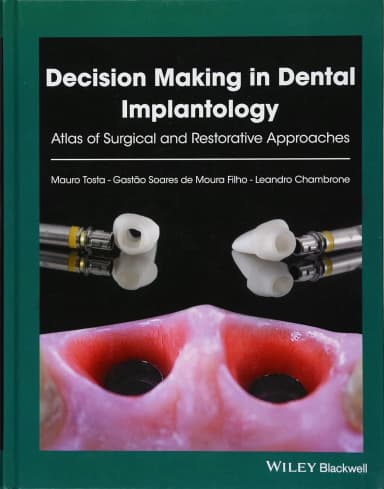 Image of - Decision Making in Dental Implantology | Hardcover