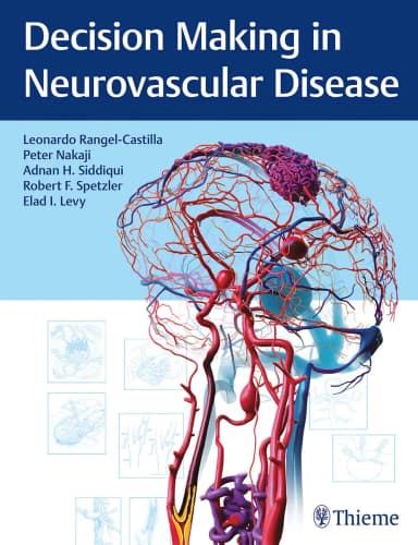 Image of - Decision Making in Neurovascular Disease | Hardcover