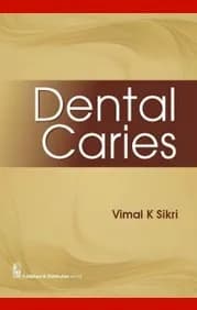 Image of - Dental Caries | Paperback