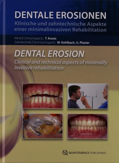 Image of - Dental Erosionen Dental Erosion | DVD Rom Only