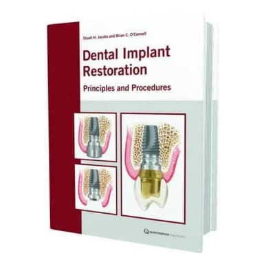 Image of - Dental Implant Restoration Principles and Procedures | Hardcover
