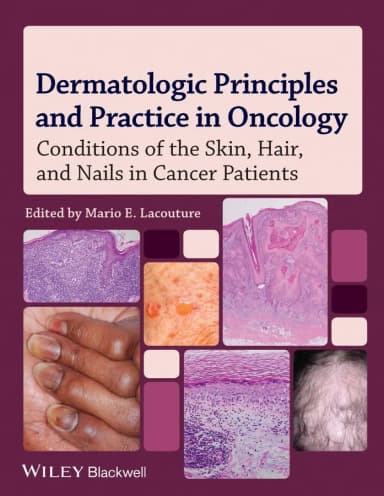Image of - Dermatologic Principles and Practice in Oncology | Hardcover