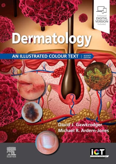 Image of - Dermatology An Illustrated Colour Text With Access Code 7th Edition | Paperback