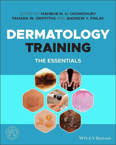Image of - Dermatology Training The Essentials | Paperback