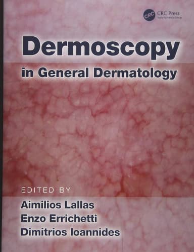 Image of - Dermoscopy in General Dermatology | Hardcover