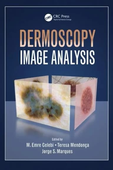 Image of - Dermoscopy Image Analysis | Hardcover