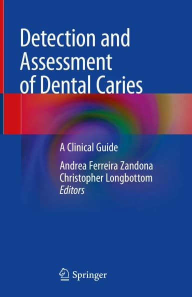 Image of - Detection and Assessment of Dental Caries | Hardcover