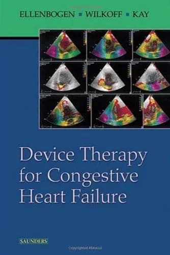 Image of - Device Therapy for Congestive Heart Failure | Paperback