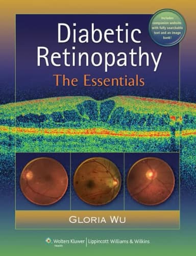 Image of - Diabetic Retinopathy The Essentials | Hardcover
