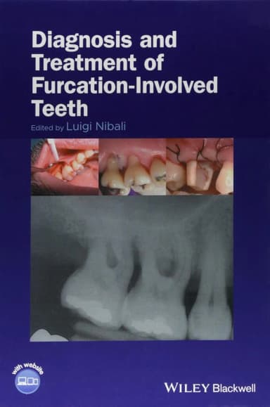 Image of - Diagnosis and Treatment of Furcation-Involved Teeth | Hardcover