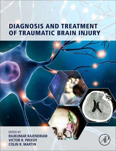 Image of - Diagnosis And Treatment Of Traumatic Brain Injury | Hardcover