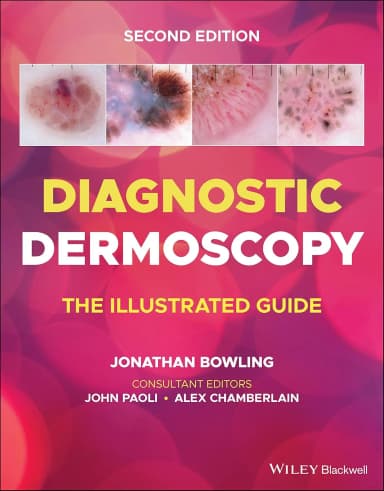 Image of - Diagnostic Dermoscopy The Illustrated Guide 2nd Edition | Paperback