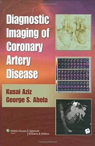 Image of - Diagnostic Imaging of Coronary Artery Disease | Hardcover