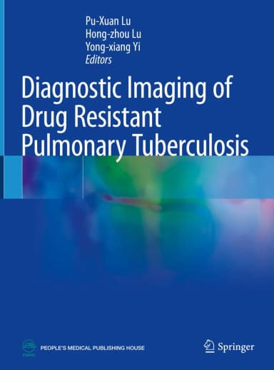 Image of - Diagnostic Imaging Of Drug Resistant Pulmonary Tuberculosis | Hardcover