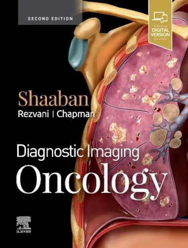 Image of - Diagnostic Imaging Oncology | 2nd Edition | Hardcover