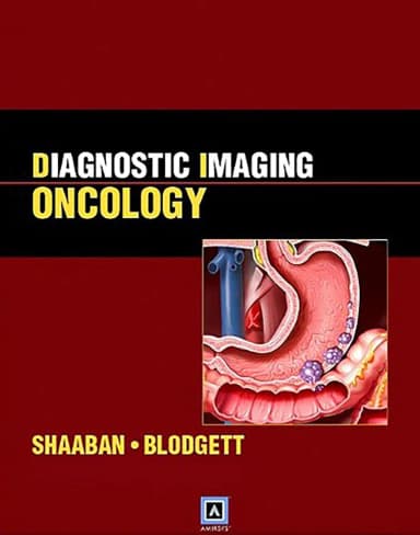 Image of - Diagnostic Imaging Oncology | Hardcover