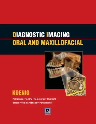 Image of - Diagnostic Imaging Oral and Maxillofacial | Hardcover