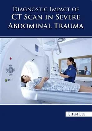 Image of - Diagnostic Impact of CT Scan In Severe Abdominal Trauma | Hardcover