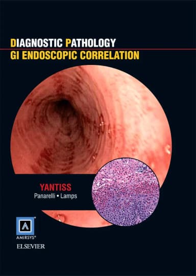 Image of - Diagnostic Pathology GI Endoscopic Correlation | Hardcover