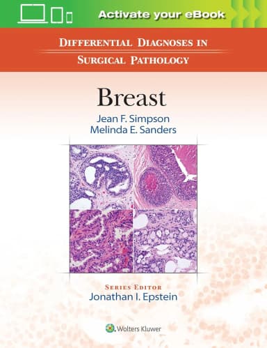 Image of - Differential Diagnoses in Surgical Pathology Breast | Hardcover