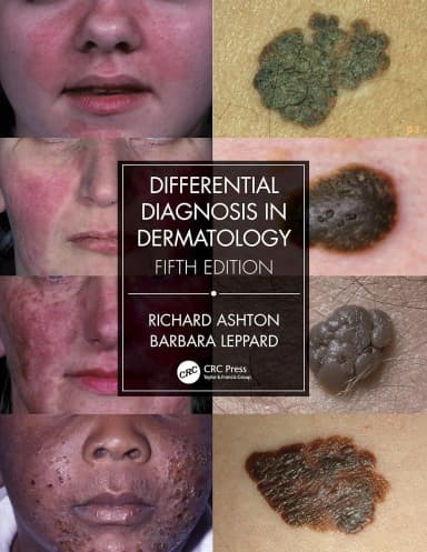 Image of - Differential Diagnosis In Dermatology | 5th Edition | Paperback