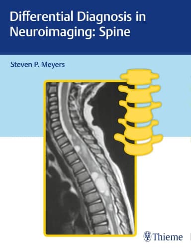 Image of - Differential Diagnosis in Neuroimaging Spine | Hardcover