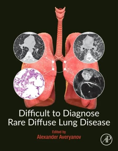 Image of - Difficult To Diagnose Rare Diffuse Lung Disease | Paperback