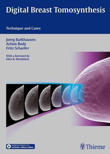 Image of - Digital Breast Tomosynthesis | Hardcover