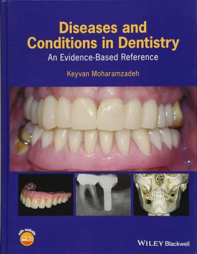 Image of - Diseases and Conditions in Dentistry | Hardcover